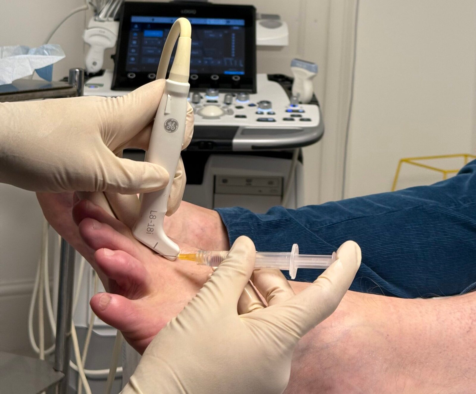 Steroid injections